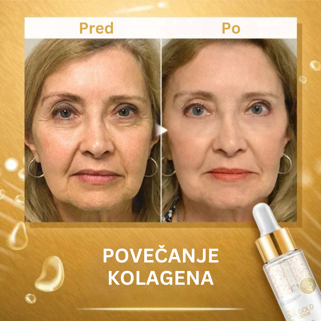 24K Zlati Serum z Kolagenom Za Spodbujanje Kože