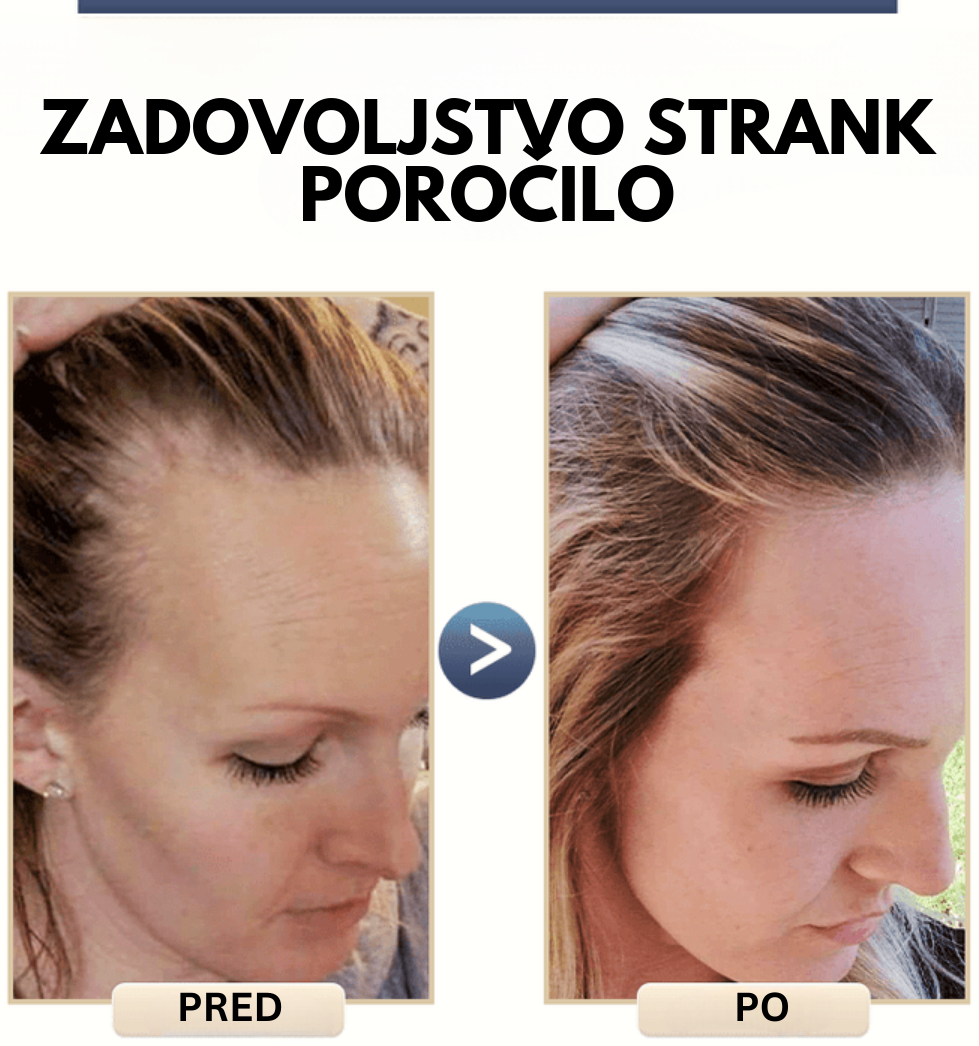 Šampon Proti Izpadanju Las Iz Riža